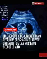 Le Manifest - 🚨🧬 Choc ADN au Brésil : une jeune mère découvre que ses jumeaux… n’ont pas le même père 🤯 Un cas ultra rare de superfécondation hétéropaternelle, confirmé par les tests ADN et repris par Times of India. La biologie ne cesse de surprendre