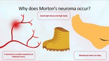 Why does Morton's neuroma occur?