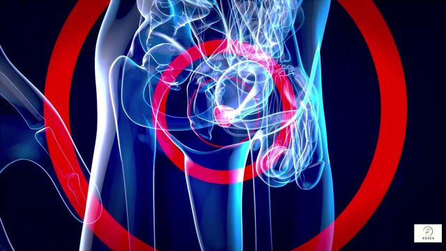 “Prostate Cancer After 60 Why Early Detection Makes It One of the Most Treatable Cancers Today”