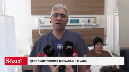 3 yıldır çene ağrısı çekiyordu; tanısı dünyadaki ilk vaka olarak kayıtlara geçti