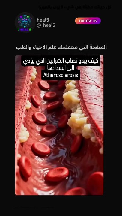 لاتنسى متابعة صفحتنا العلمية، لترويــ ـج حسابك باسـ ـعار مناسبة ارسل كلمة اعــ ـلان ع(