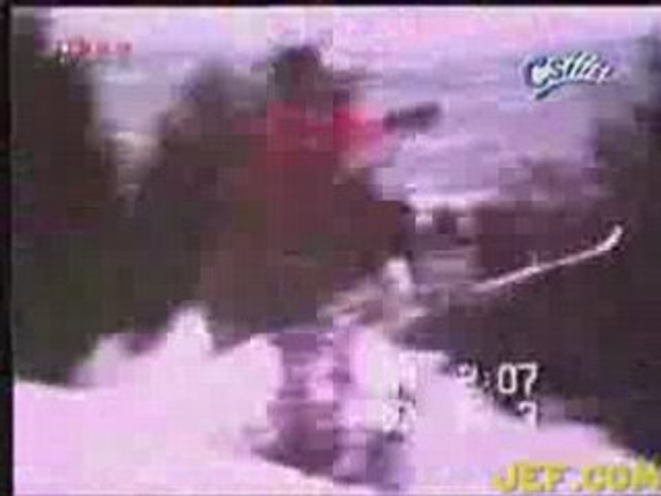 Skier vs Tree. Skier 0 - Tree 1. Painful skiing accident!