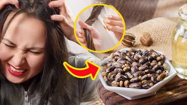 Castor Oil Benefits For Hair:सर्दियों में आरंडी का तेल बालों में लगाने के फायदे| Benefits In Winter