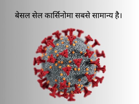 Types of Skin Cancer | Important Classification Explained