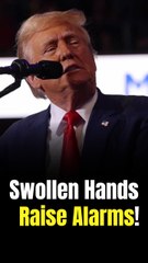 Concerns Grow Over Trump’s Health After G7 Appearance and Press Complaints