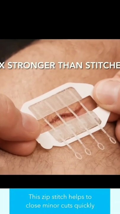 Zipper Tie Wound Closure Patch – Fast, Secure, and Suture-Free Healing