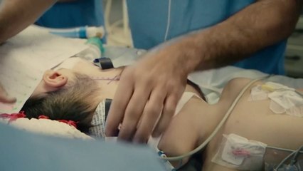 Separación De Siameses