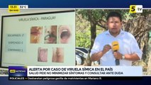 Alerta por caso de viruela símica en el país