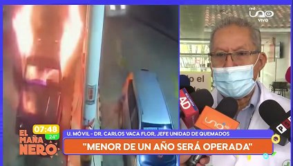 HERMANITOS QUEMADOS, OPERAN A LA MENOR