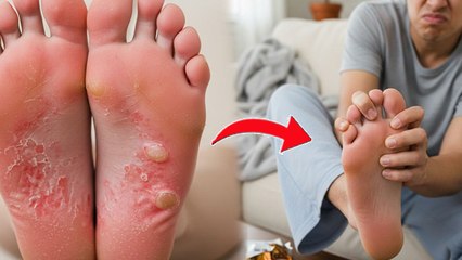 Causes Of Foot Itching : पैरों के तलवों में खुजली क्यों होती है | Feet Itching Home Remedy | Boldsky