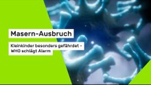 Masern-Ausbruch: Kleinkinder besonders gefährdet - WHO schlägt Alarm