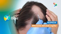 Alopecia: Alteración del ciclo capilar
