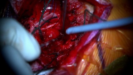 trauma room one s02e06