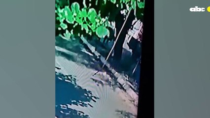 Joven de 22 años pierde la pierna en accidente de tránsito