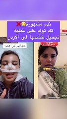 نورة الدوسري تشكو من تجميل أنفها