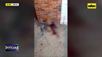 Balean a un hombre tras partida de billar: recibió dos disparos