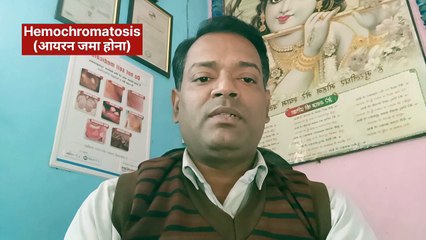 Liver cirrhosis causes । लीवर सिरोसिस होने के कारण ।