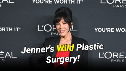 Kris Jenner Reveals the ‘Only Thing on My Face That’s Real’ in Wild Plastic Surgery Confession