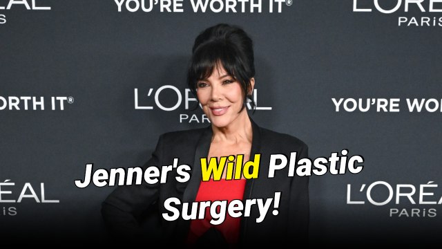 Kris Jenner Reveals the ‘Only Thing on My Face That’s Real’ in Wild Plastic Surgery Confession