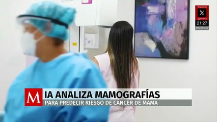 Nueva IA predice riesgo de cáncer de mama con análisis avanzado de mamografías