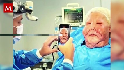 Influencer inicia reconstrucción facial tras cirugía clandestina que la desfiguró