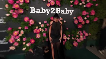 Kylie Jenner Reveals The Only Work She Had Done On Her Face After Surgery ‘Misconceptions’