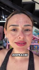 Influencer mexicana sufrió graves quemaduras en la cara por hacer un reto viral