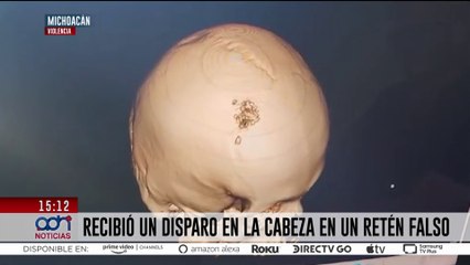 Retén falso en Michoacán cambia la vida de un hombre; recibió un disparo en la cabeza