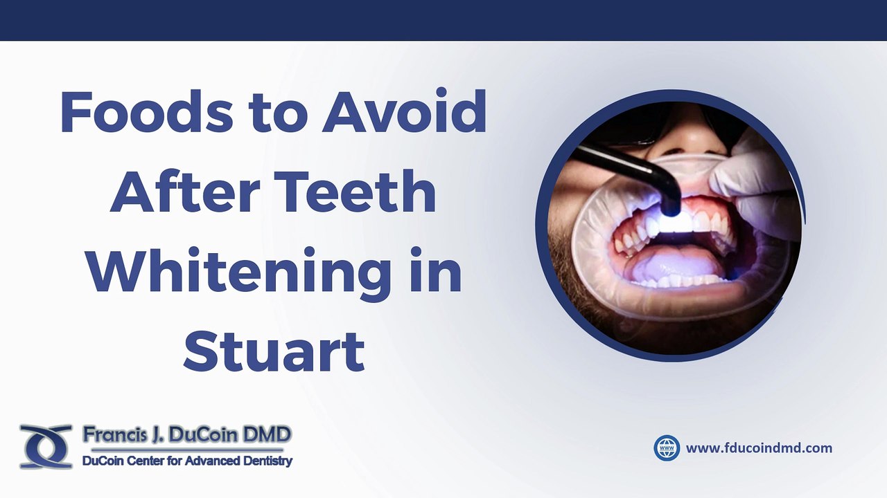 Foods to Avoid After Teeth Whitening in Stuart