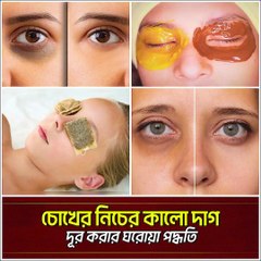 চোখের নিচের কালো দাগ দূর করুন মাত্র ৭ দিনে! 🥔 সহজ ঘরোয়া পদ্ধতি  Dark Circles Home Remedy