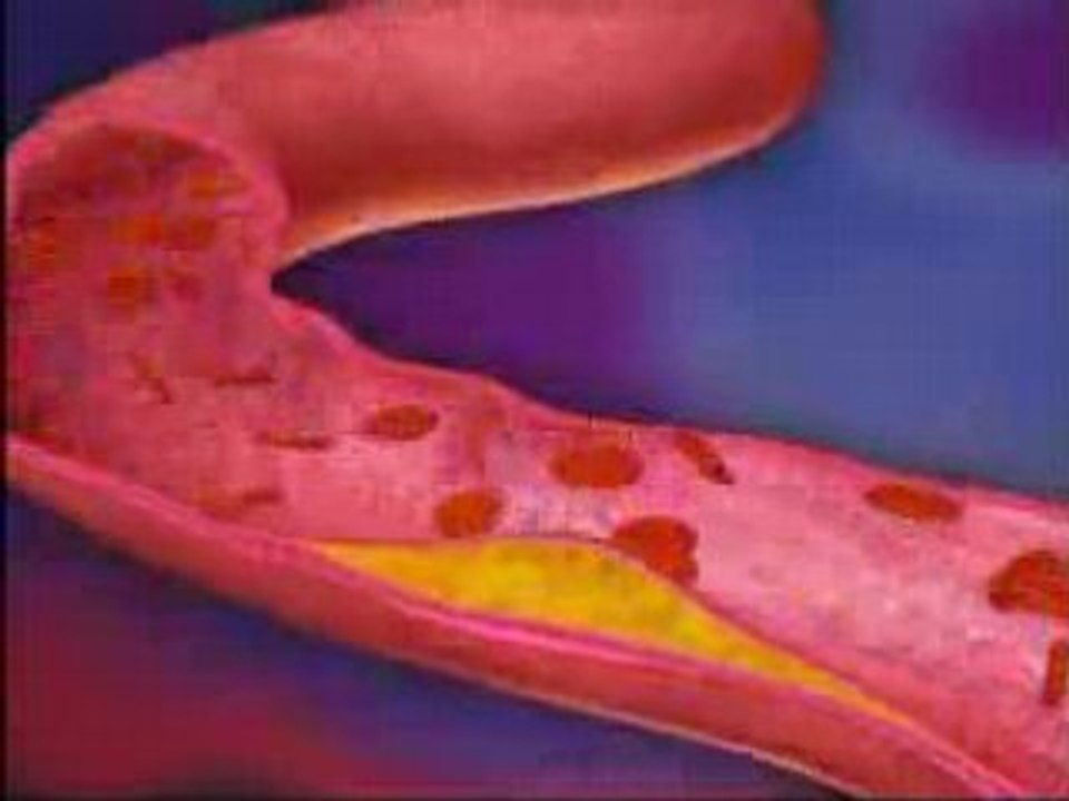 Blood Pressure Monitor