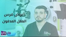 أعراض ضرس العقل المدفون