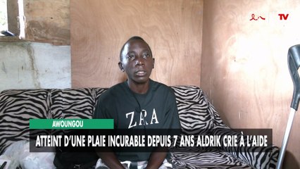 [#Reportage] Awoungou : atteint d’une plaie incurable depuis 7 ans Aldrik crie à l’aide