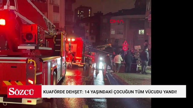 Kuaförde dehşet: 14 yaşındaki çocuğun tüm vücudu yandı!