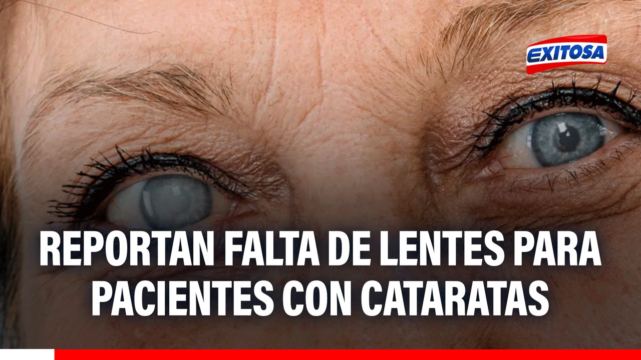 Se quedan sin cirugías: Reportan falta de lentes para pacientes con cataratas
