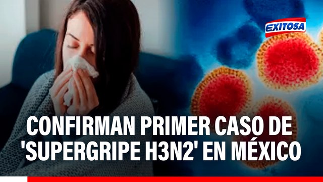 Confirman primer caso de 'Supergripe H3N2' en MÉXICO