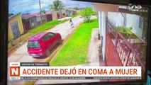 ATROPELLAN A UNA MUJER EN SANTA CRUZ