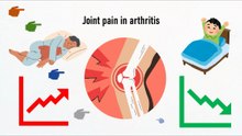 Joint pain in arthritis
