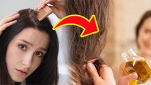 Dandruff In Winter:सर्दियों में अगर बालों में डैंड्रफ हो जाए तो क्या करें,Instant Relief Home Remedy