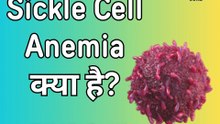 What Is Sickle Cell Anemia?