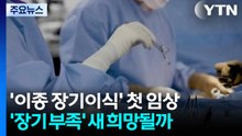 '이종 장기이식' 첫 임상...'장기 부족' 새 희망될까 / YTN