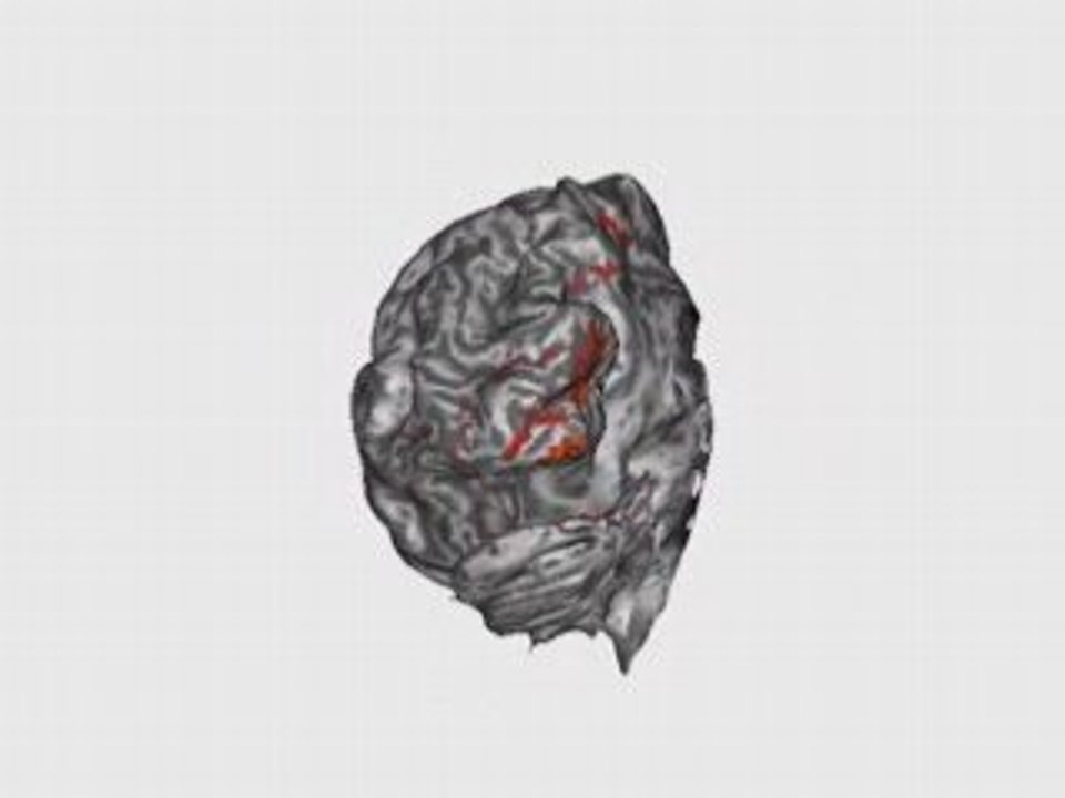 Cortex_unfolding