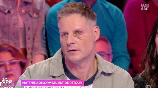 Matthieu Delormeau de retour avec un oeil au beurre noir dans TBT9 : “Personne ne croit à ce qu’il s’est passé”
