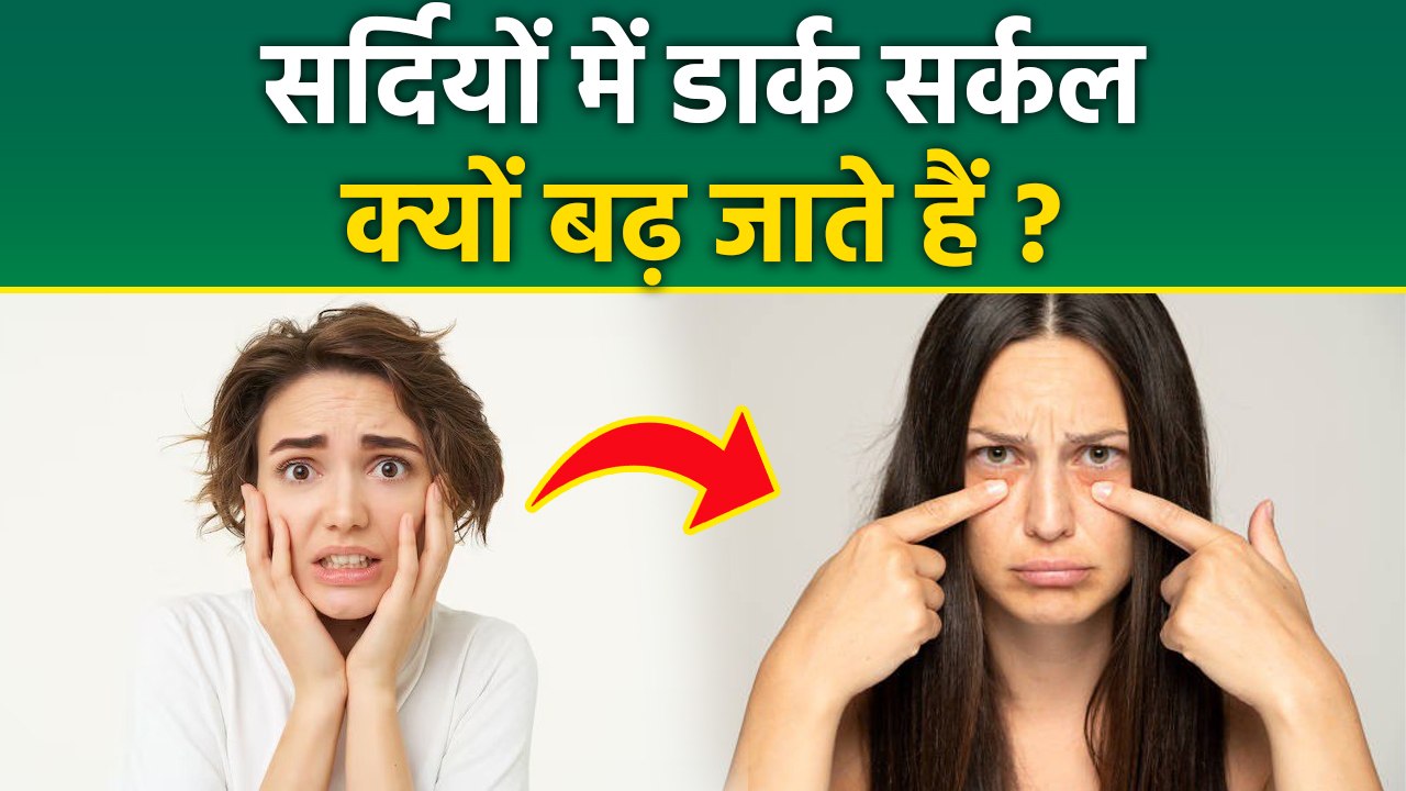 Dark Circles In Winter Season: Sardiyon Mein Aankhon Ke Niche Dark Circle Hone Ka Kya Karan Hai?