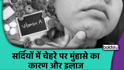 Winter Acne Kyun Hota Hai ? Vitamin A, D & Zinc Deficiency Ka Asar