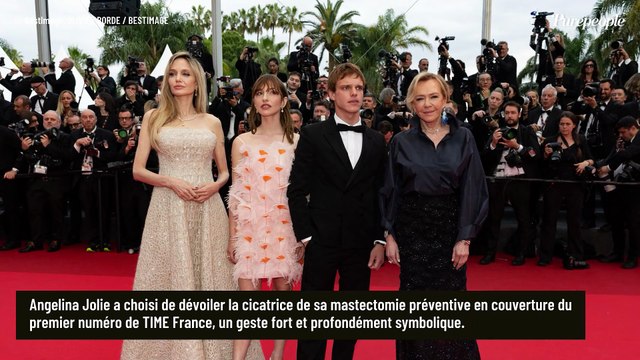 Pour la première fois, cette actrice iconique montre les traces laissées par son opération