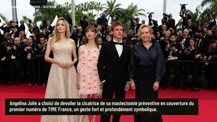 Pour la première fois, cette actrice iconique montre les traces laissées par son opération