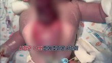 몸 바깥에서 심장 뛰던 '서린이', 국내 첫 수술 성공..."절망 속 희망 준 의료진께 감사" [앵커리포트] / YTN
