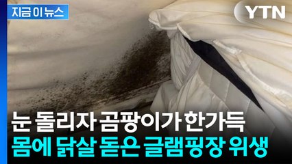 "23만 원 내고 병 얻어갈 듯"...노숙 체험 수준의 글램핑장 충격 위생 [지금이뉴스] / YTN