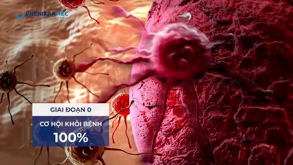 Những đóng góp của ThS. BS Vũ Thị Thu cho lĩnh vực điều trị ung thư hiện nay